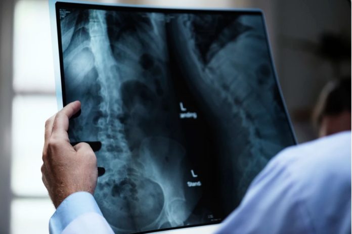 X-ray doctor