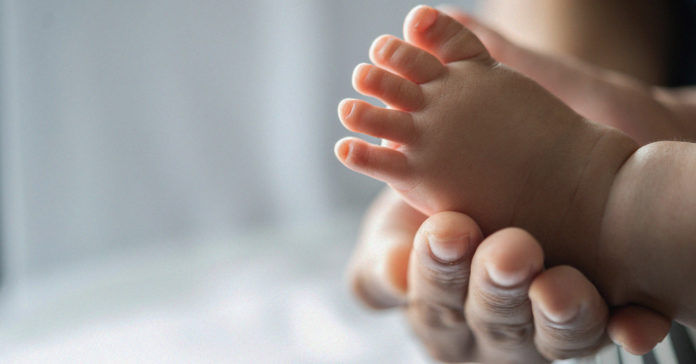 childbirth intervention